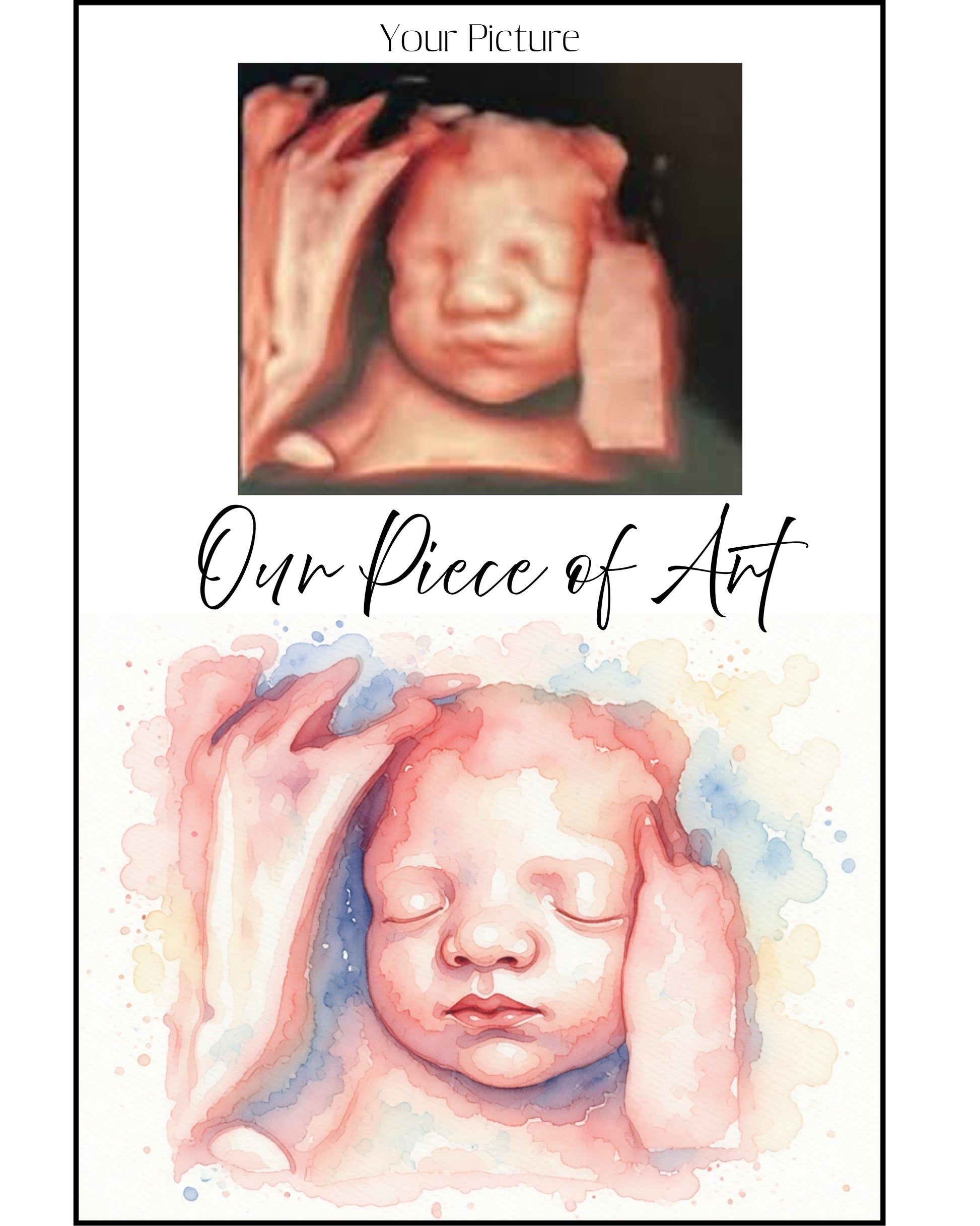 Ultrasound Memory Art | Custom Baby Sonogram Poster | Metal Print
