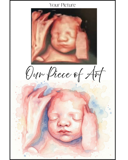 Ultrasound Memory Art | Custom Baby Sonogram Poster | Metal Print